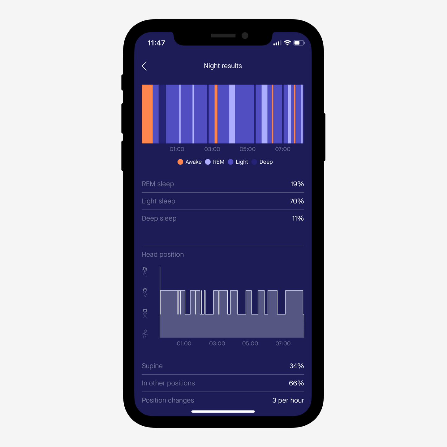 Sunrise Sleep Diagnostic Home Sleep Test