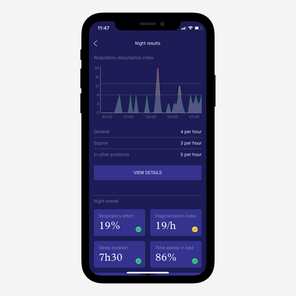 Sunrise Sleep Diagnostic Home Sleep Test