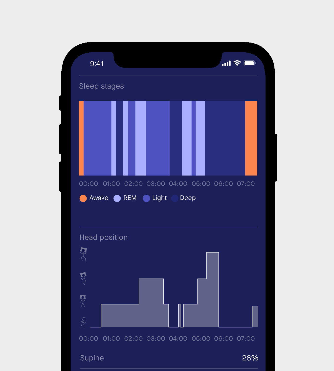 Sunrise Sleep Diagnostic Home Sleep Test